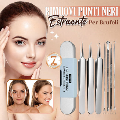 💓50% DI SCONTO💥Kit Strumento Rimuovi Punti Neri e Estraente per Brufoli