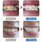 🦷 -50% Pulitore Dentale Ultrasonico Elettrico