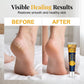 Crema idratante riparatrice anti-screpolature per i piedi