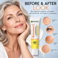 🍊 Siero Viso Vitamina C ad Assorbimento Profondo